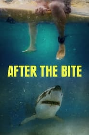watch-After the Bite